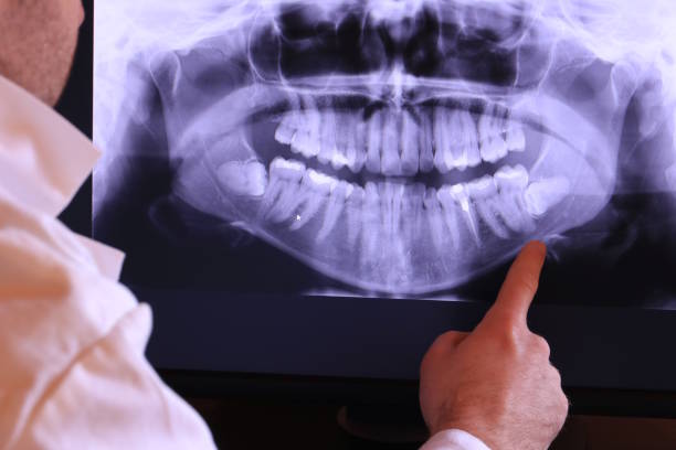 Best Emergency Dentist for Knocked-Out Tooth in Reeds Spring, MO