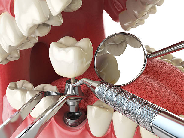 Best Emergency Dentist for Special Needs Patients in Reeds Spring, MO